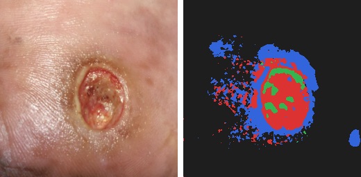 Generated tissue overlay